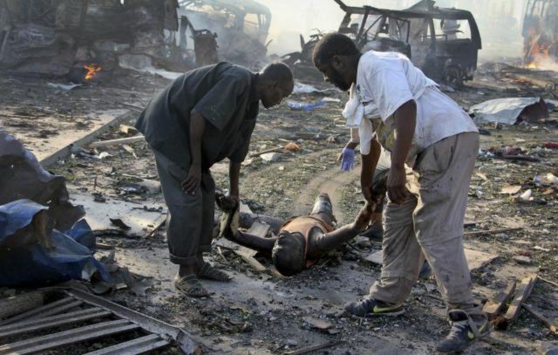 Raste broj žrtava: 85 mrtvih u bombaškom napadu