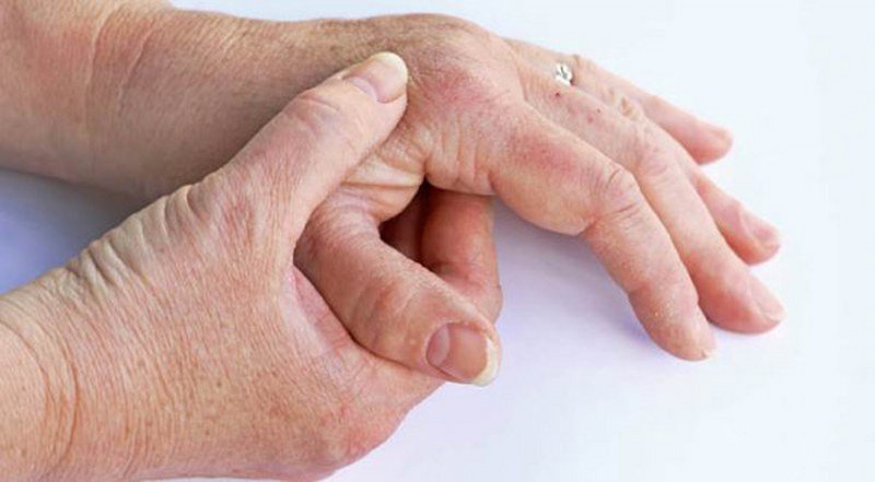 Psorijazni artritis