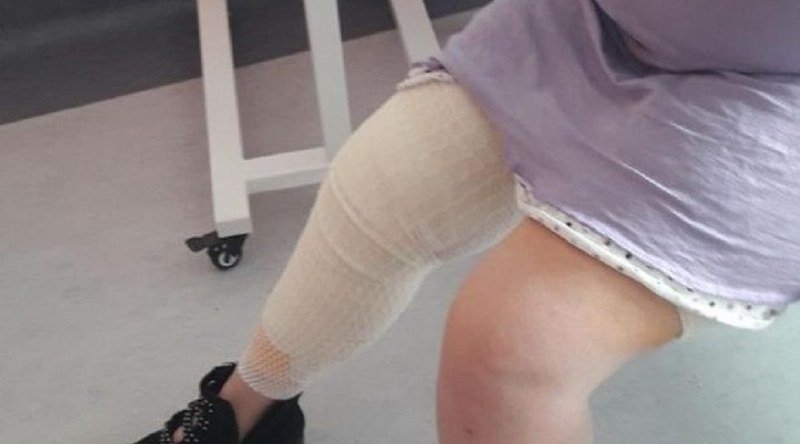 Nišlijki tokom operacije žuči mašina spržila nogu