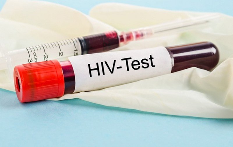 Naučnici iz Hong Konga tvrde da su pronašli novi lijek za HIV   