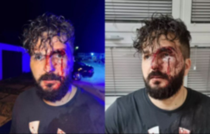 Uznemirujući snimci! Užas u Brčkom, brutalno pretučen novinar Mirza Dervišević, s leđa ga je napao...