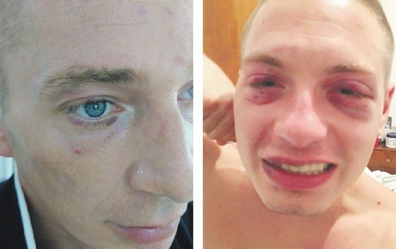 Miloviće tukli, pa ucjenjivali da ćute?