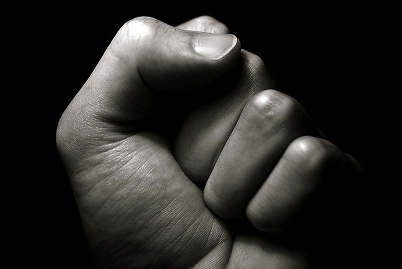 Napadnuti lekari u Zaječaru, pretnje smrću i udarac