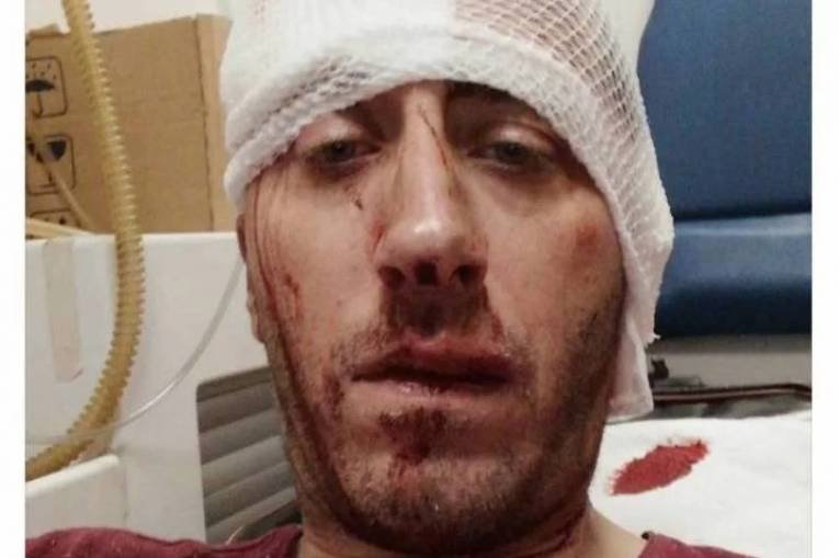 UO BH novinara -Objavite imena napadača ili slijedi protest novinara!-