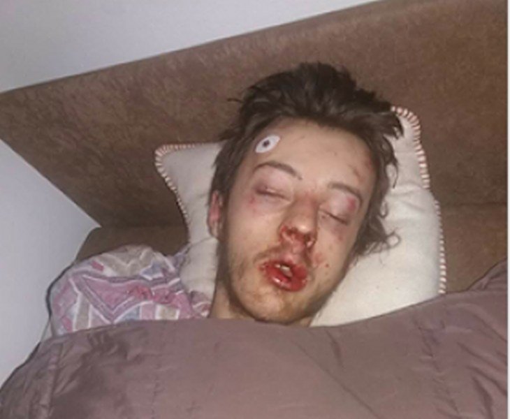 Policijsko-Pravosudni Kartel ne prašta: Nova kriminalizacija Bogdana Rakića nakon batinanja od narko-dilera