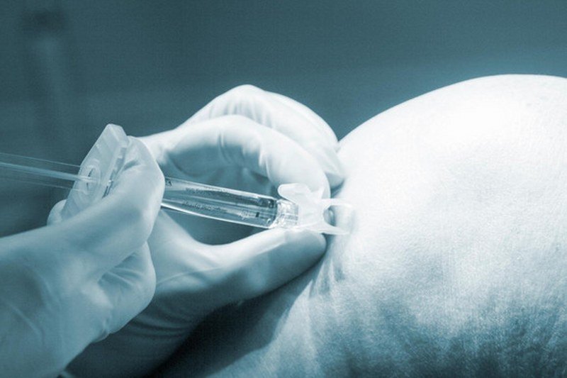 Osam žena umrlo nakon estetskih operacija, a onda je klupko počelo da se odmotava