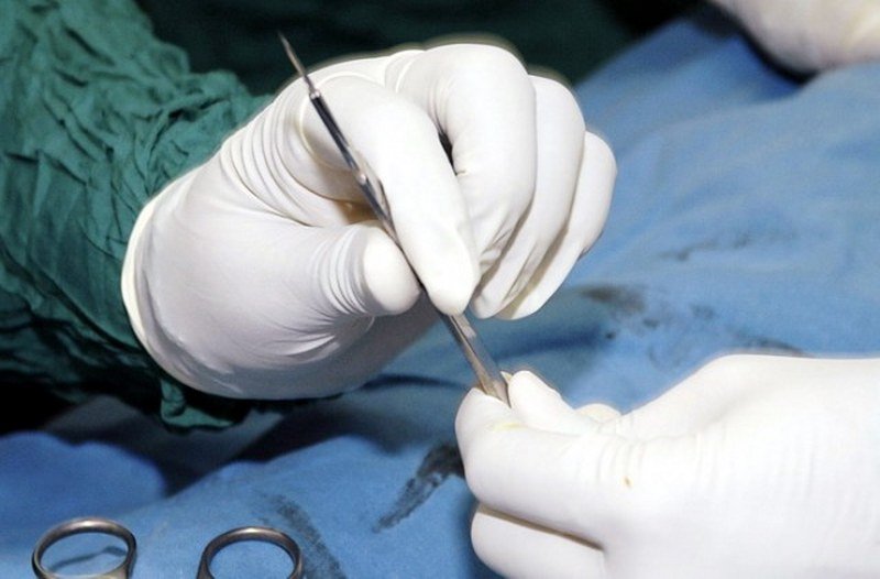 Skrivena strahota: Evo kako su, za šest godina, prodati organi 15.000 zarobljenih Sirijaca