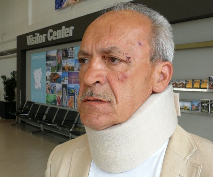 Bruno Batinić koji je sinoć pretučen u Banja Luci najavio krivične prijave -Trenutno sam u bolnici-