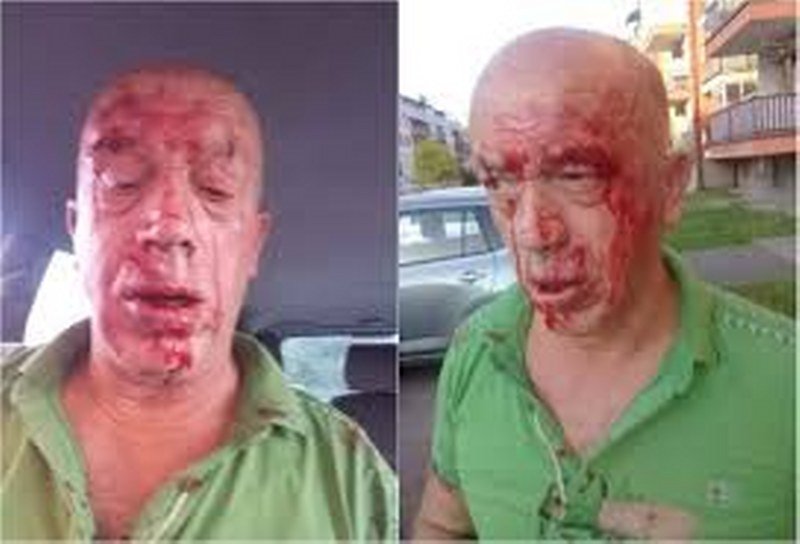 Načelnik Civilne zaštite brutalno pretučen u centru Teslića - Djeca vrištala i plakala