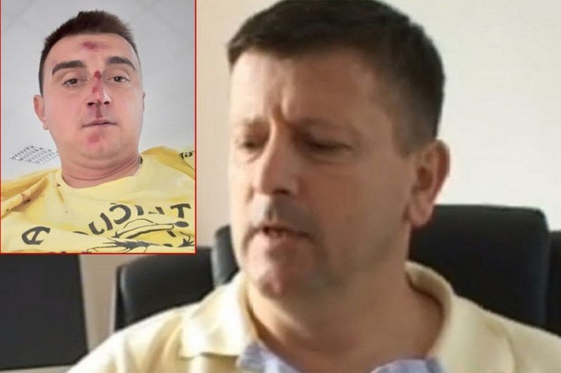 Bivši načelnik me pretukao, jer sam tražio da mi vrati dug