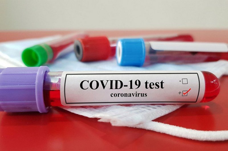 Virus korona ušao i u EUFOR