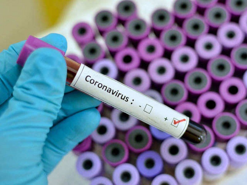 Virus nastavlja da napada, neće čekati da se bilo ko beskrajno -dogovara-