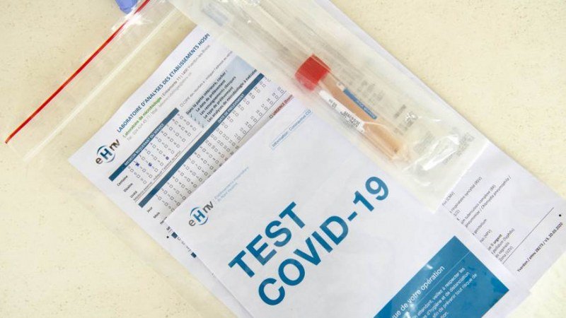 Sramota - Test na koronu u RS 200 KM, a u FBiH 60 KM - Građani ogorčeni