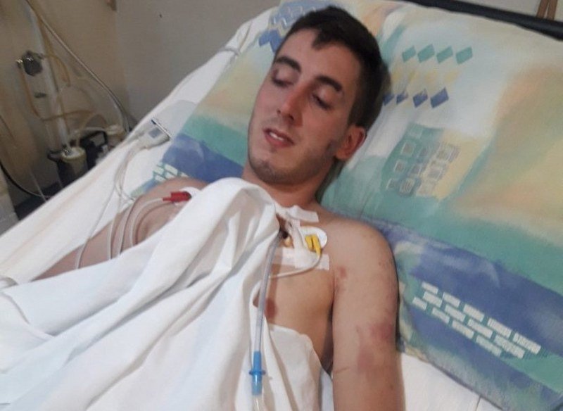 Policajac oteo i brutalno pretukao mladića - Hitno operisan (Foto/Video)