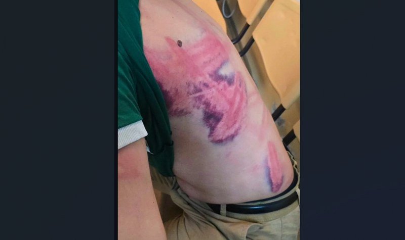 Igor Mandić: Mučnina, ogorčenje i tuga zbog brutalnog policijskog nasilja u Srbiji (Foto/Video)