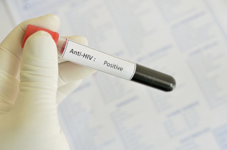 Naučnici razvili lek koji će moći da izleči HIV i sidu