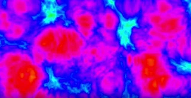Ovako izgleda mozak na LSD-u (VIDEO)