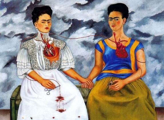 Frida Kalo – umjetnica prema kojoj niko nije ravnodušan